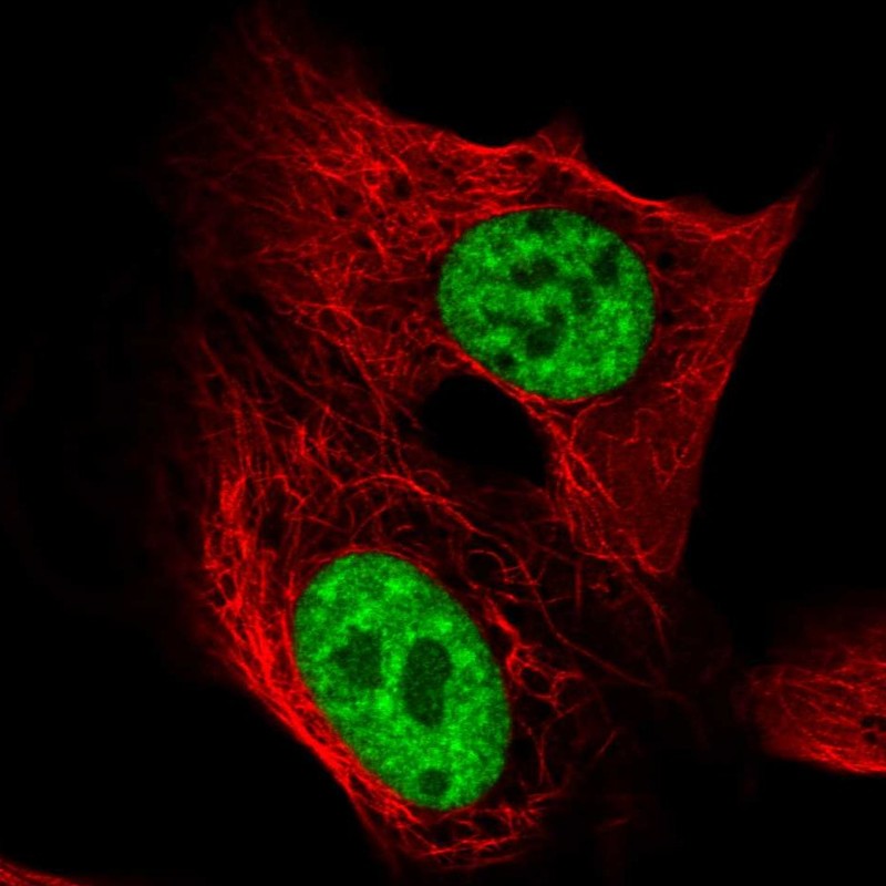 Atlas Antibodies Anti-TCERG1 Antibody