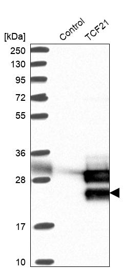 Atlas Antibodies Anti-TCF21 Antibody