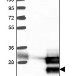 Atlas Antibodies Anti-TCF21 Antibody