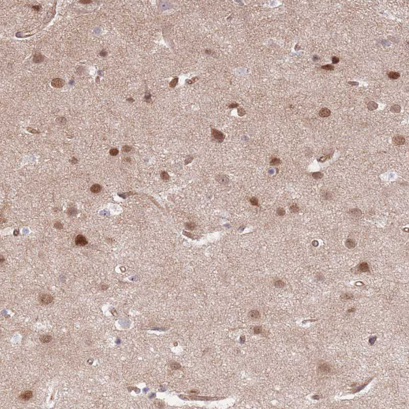 Atlas Antibodies Anti-TCF20 Antibody