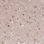 Atlas Antibodies Anti-TCF20 Antibody