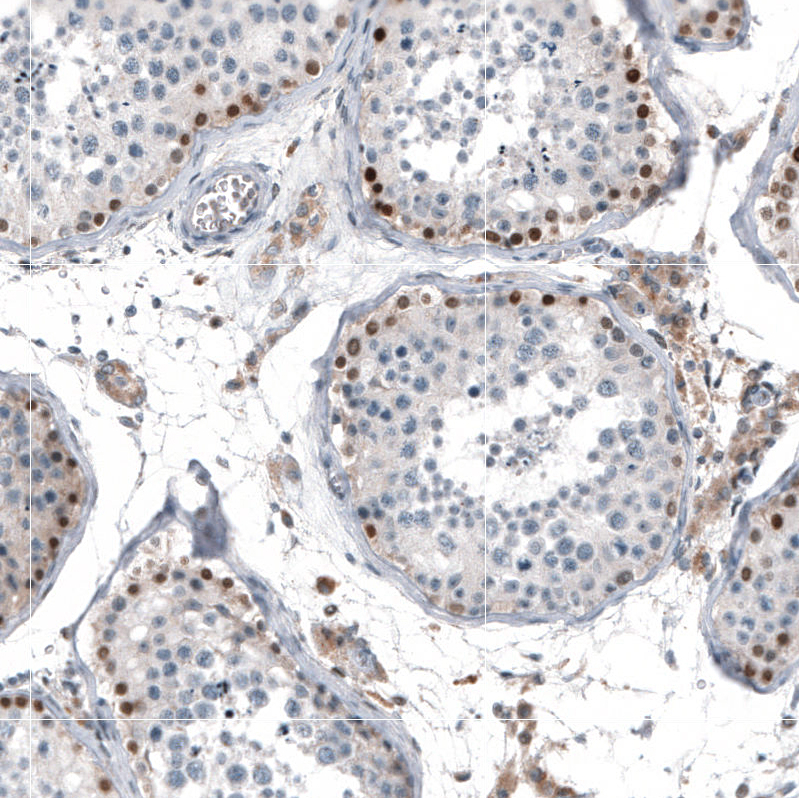 Atlas Antibodies Anti-TCF3 Antibody