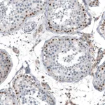 Atlas Antibodies Anti-TCF3 Antibody