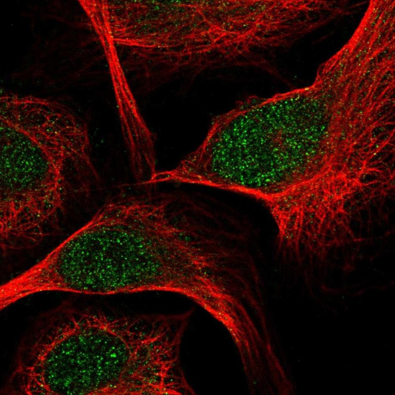 Atlas Antibodies Anti-TCF7 Antibody