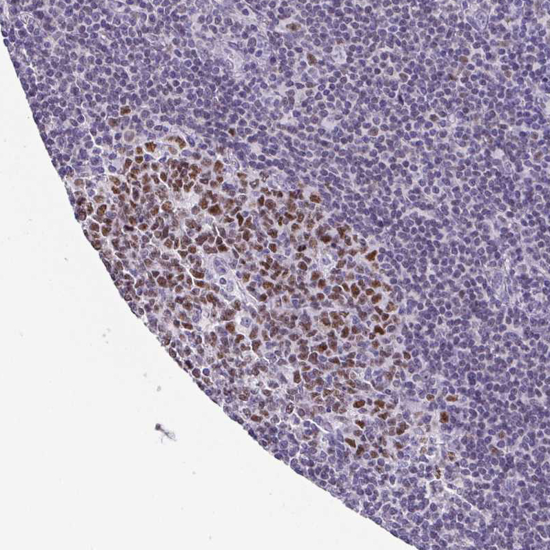 Atlas Antibodies Anti-TCF3 Antibody