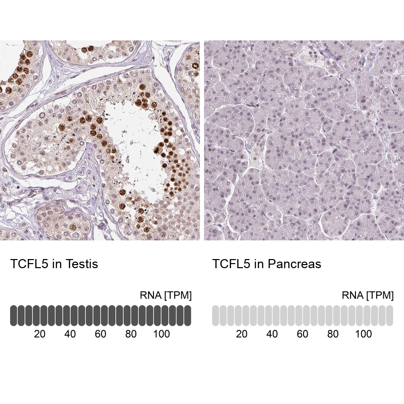 Atlas Antibodies Anti-TCFL5 Antibody