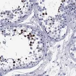 Atlas Antibodies Anti-TCFL5 Antibody