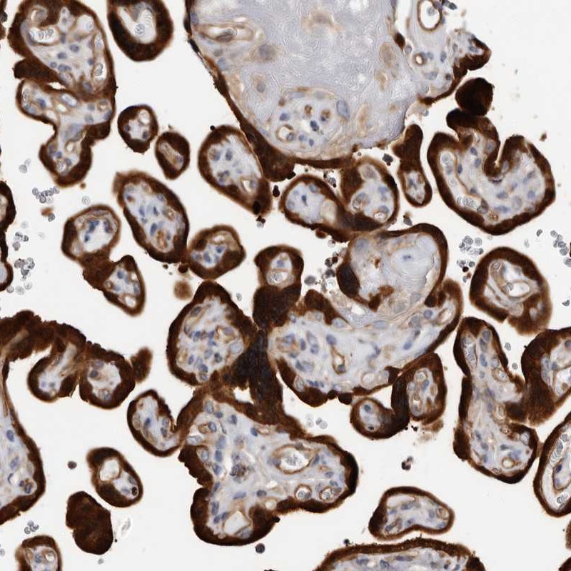 Atlas Antibodies Anti-TCHH Antibody