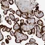 Atlas Antibodies Anti-TCHH Antibody