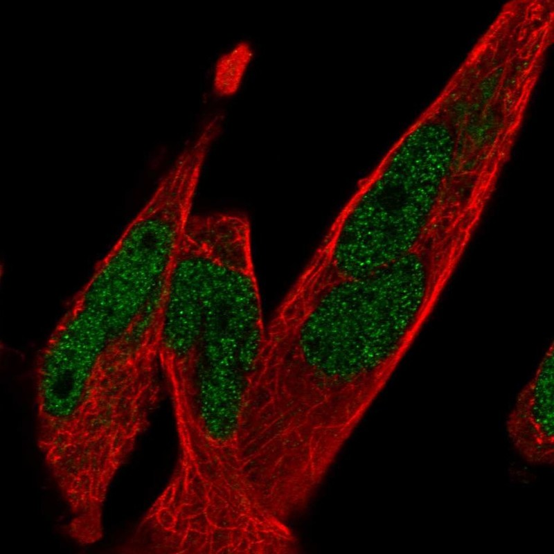 Atlas Antibodies Anti-TCF7L1 Antibody