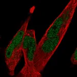 Atlas Antibodies Anti-TCF7L1 Antibody