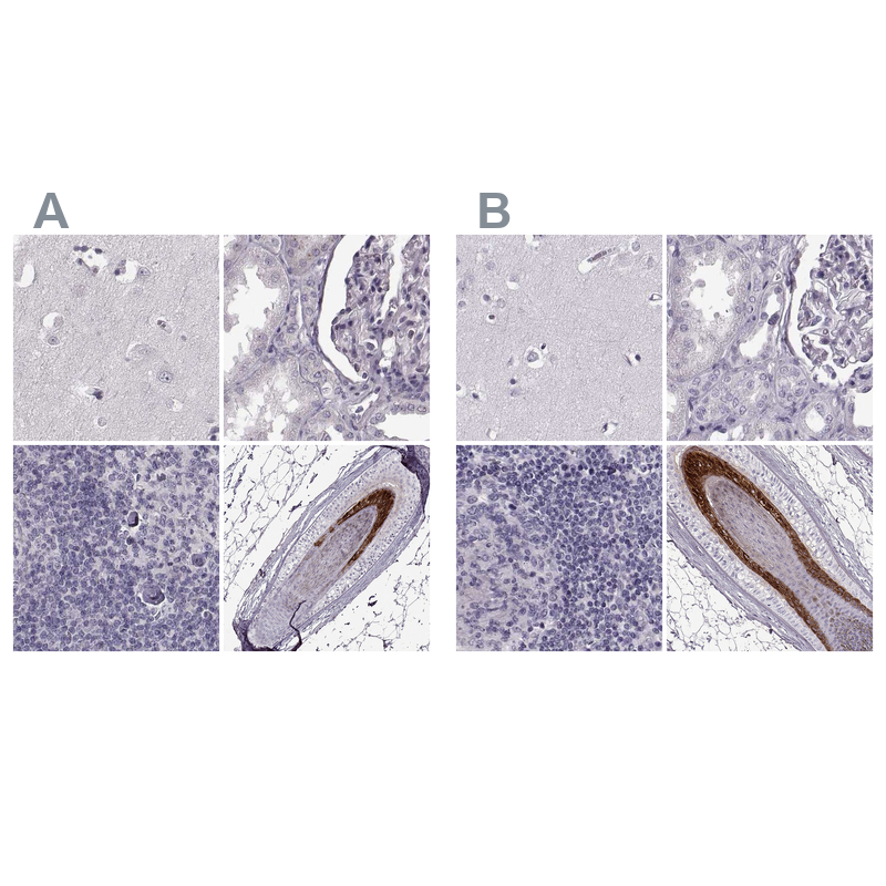 Atlas Antibodies Anti-TCHHL1 Antibody
