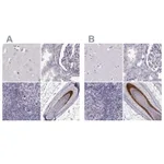 Atlas Antibodies Anti-TCHHL1 Antibody
