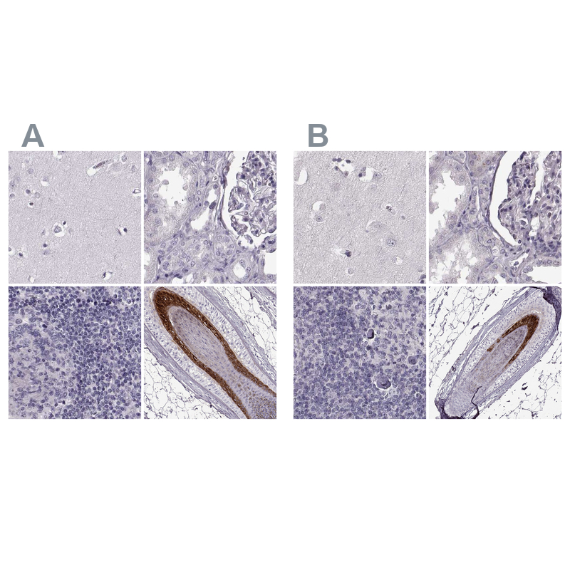 Atlas Antibodies Anti-TCHHL1 Antibody