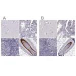 Atlas Antibodies Anti-TCHHL1 Antibody