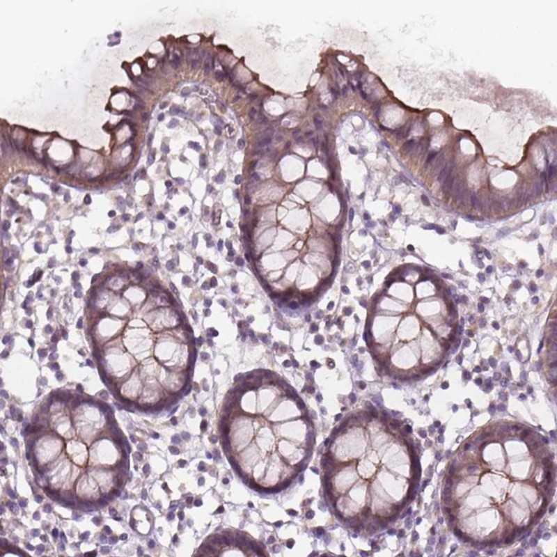 Atlas Antibodies Anti-TCHP Antibody
