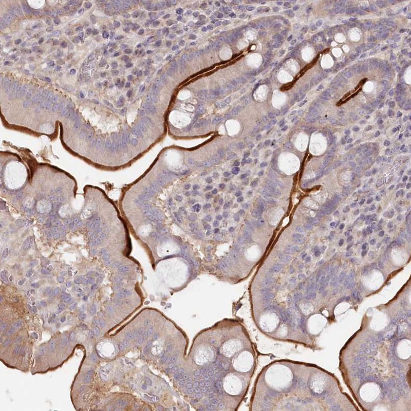 Atlas Antibodies Anti-TCHP Antibody