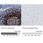 Atlas Antibodies Anti-TCL1A Antibody