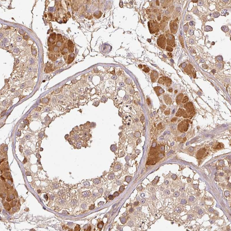Atlas Antibodies Anti-TCL1B Antibody