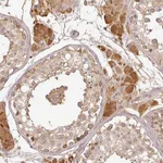 Atlas Antibodies Anti-TCL1B Antibody