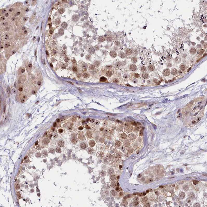 Atlas Antibodies Anti-TCOF1 Antibody