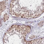 Atlas Antibodies Anti-TCOF1 Antibody