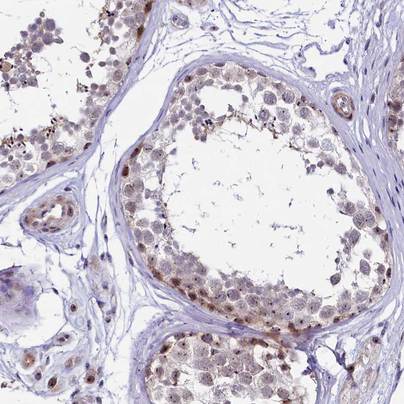 Atlas Antibodies Anti-TCOF1 Antibody
