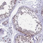 Atlas Antibodies Anti-TCOF1 Antibody