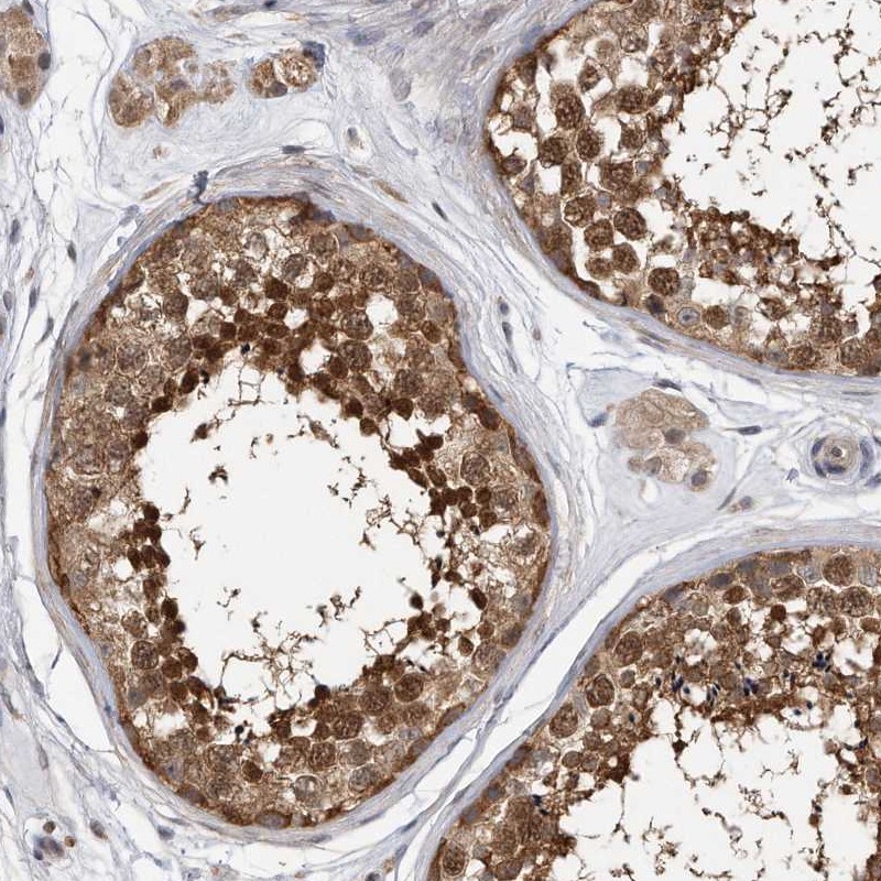 Atlas Antibodies Anti-TCP1 Antibody