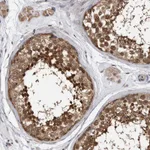 Atlas Antibodies Anti-TCP1 Antibody