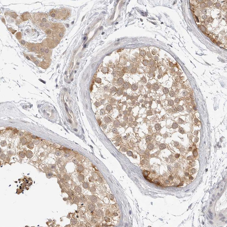 Atlas Antibodies Anti-TCP1 Antibody