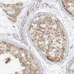 Atlas Antibodies Anti-TCP1 Antibody
