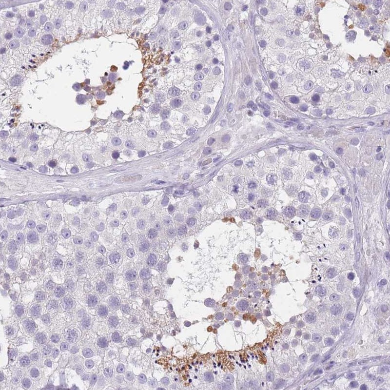 Atlas Antibodies Anti-TCP11 Antibody