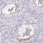 Atlas Antibodies Anti-TCP11 Antibody