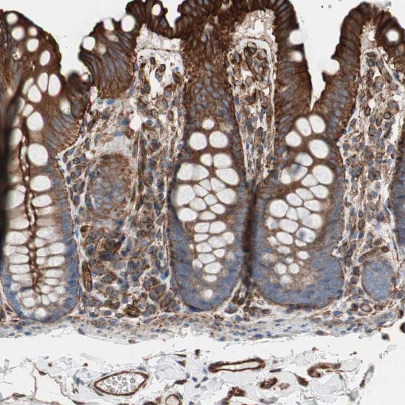 Atlas Antibodies Anti-TCTA Antibody