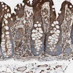 Atlas Antibodies Anti-TCTA Antibody