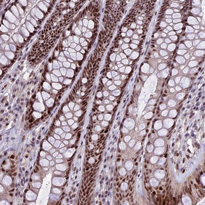 Atlas Antibodies Anti-TCP11L2 Antibody