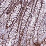 Atlas Antibodies Anti-TCP11L2 Antibody