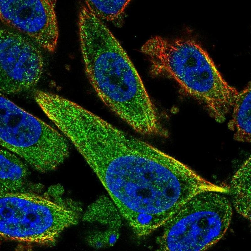 Atlas Antibodies Anti-TCTEX1D2 Antibody