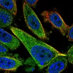 Atlas Antibodies Anti-TCTEX1D2 Antibody