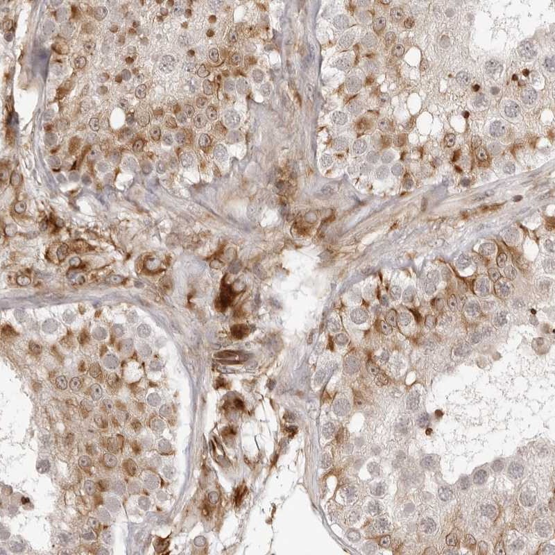 Atlas Antibodies Anti-TCTEX1D1 Antibody
