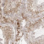 Atlas Antibodies Anti-TCTEX1D1 Antibody