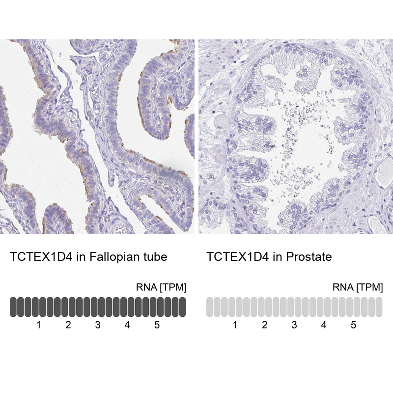 Atlas Antibodies Anti-TCTEX1D4 Antibody