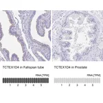 Atlas Antibodies Anti-TCTEX1D4 Antibody