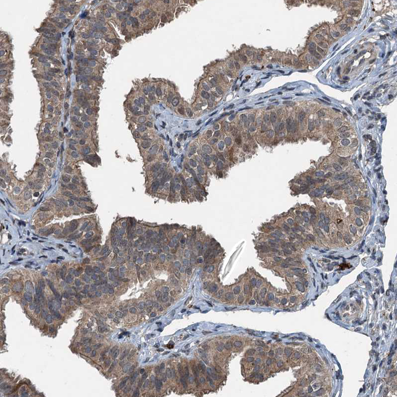 Atlas Antibodies Anti-TCTN1 Antibody