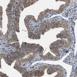 Atlas Antibodies Anti-TCTN1 Antibody