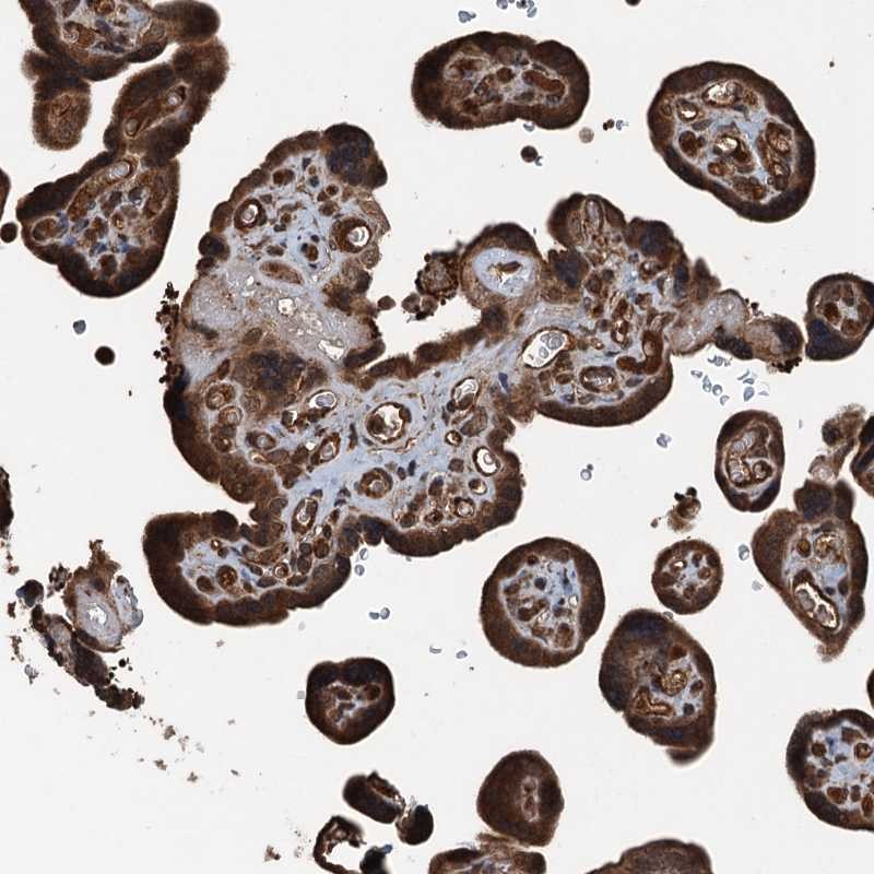 Atlas Antibodies Anti-TCTN1 Antibody