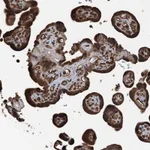 Atlas Antibodies Anti-TCTN1 Antibody