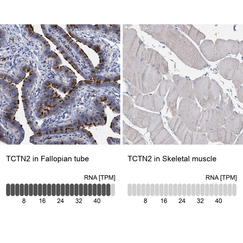 Atlas Antibodies Anti-TCTN2 Antibody
