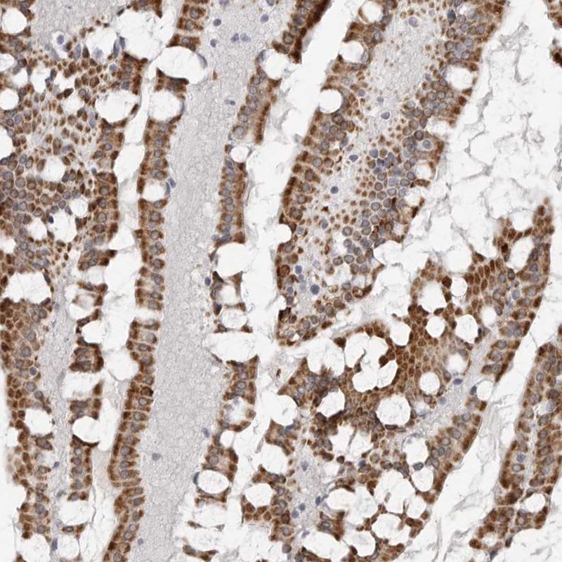 Atlas Antibodies Anti-TCTN3 Antibody